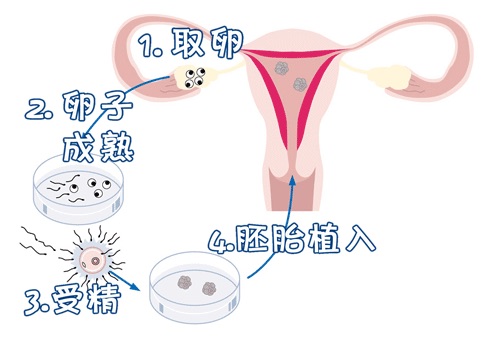 遗传咨询